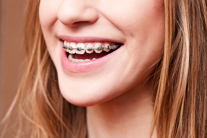 Orthodontics in Philadelphia